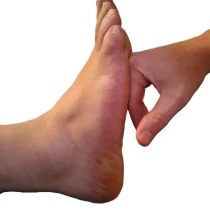 Manuelle Faszientherapie (ATSI) der Fusssohle in der Praxis Medwell Thun zur Aufrichtung und Verbesserung des Gleichgewichts.