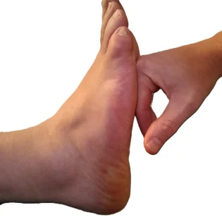 Manuelle Faszientherapie (ATSI) der Fusssohle in der Praxis Medwell Thun zur Aufrichtung und Verbesserung des Gleichgewichts.